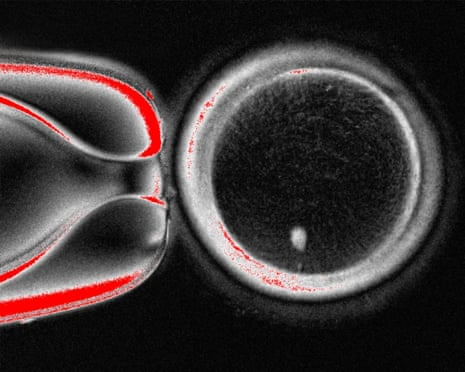 Human skin cells are turned into eggs in fertility breakthrough | Science | The Guardian